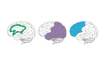 Universal Design for Learning (UDL) Image